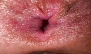 A sick ass of a mature woman met a penis in her anal