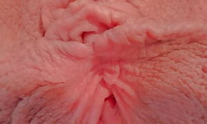 Gaping pearly labia